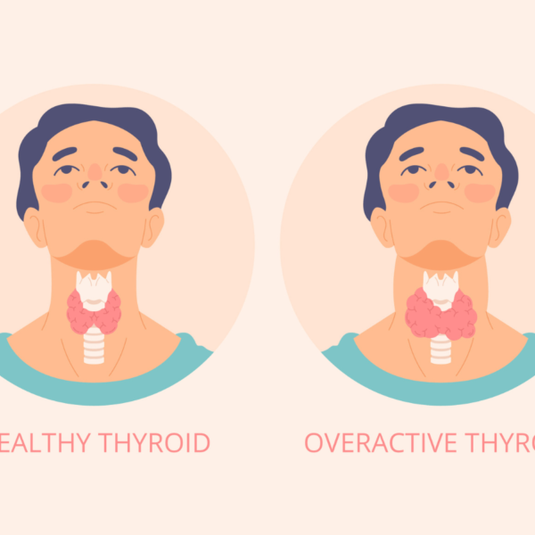 Vital Nutrients for Managing Hypothyroidism