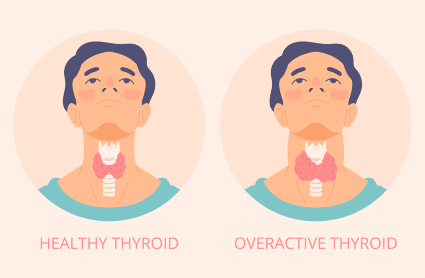 Vital Nutrients for Managing Hypothyroidism